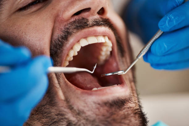 Best Walk-In Emergency Dentist in Stuarts Draft, VA