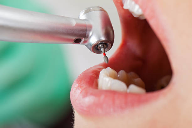 Best After-Hours Emergency Dentist in Stuarts Draft, VA